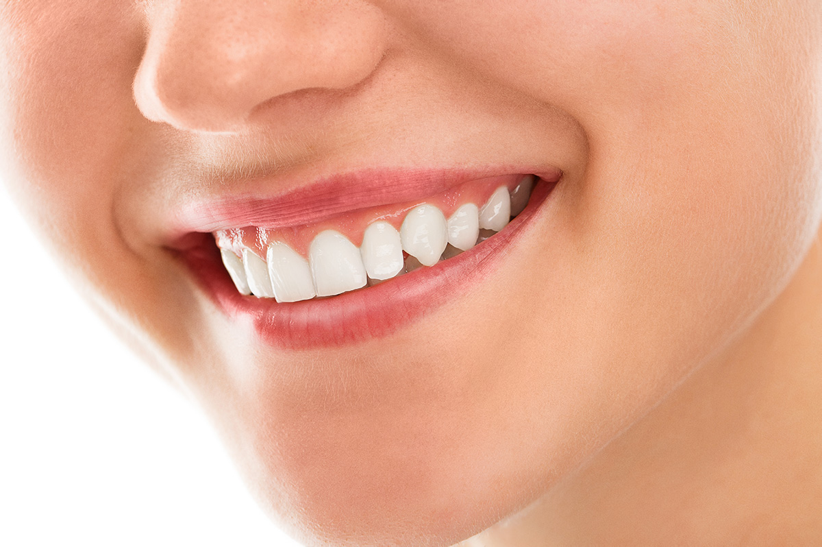 Blanchiment Dentaire, Comment Se débarrasser des dents jaunes ?