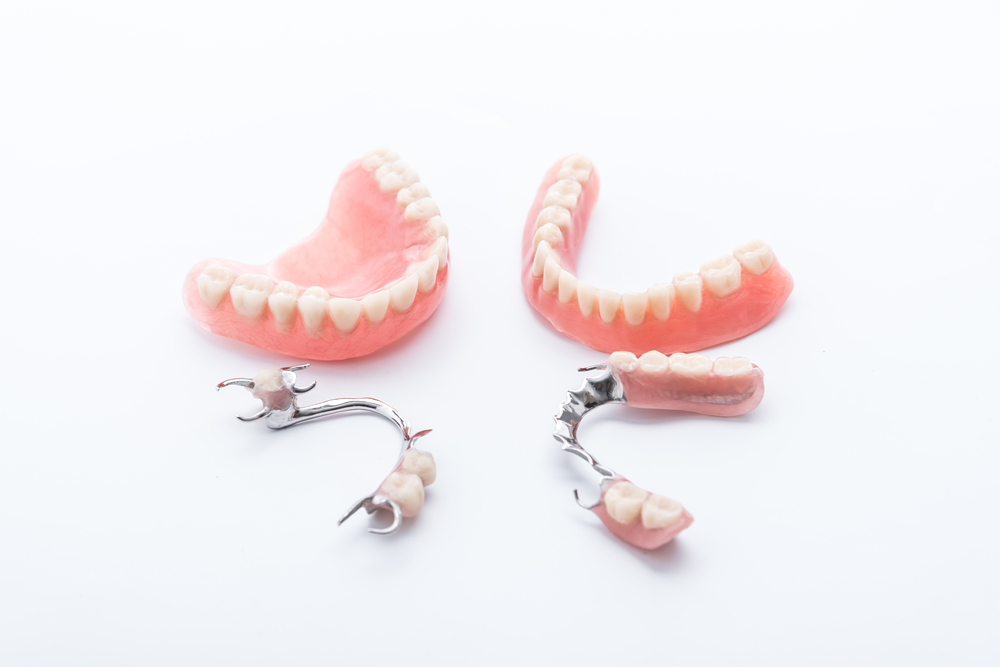 Prothèse dentaire fixe et amovible - Clinique dentaire Smile Again, Alger